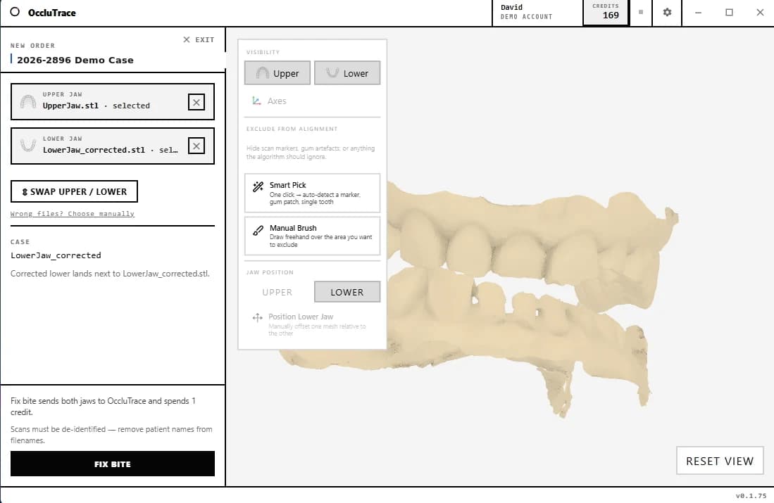 OccluTrace Connector for Windows showing a new order with upper and lower jaw scans selected, Smart Pick exclusion tools and both jaws rendered in the built-in 3D viewer.