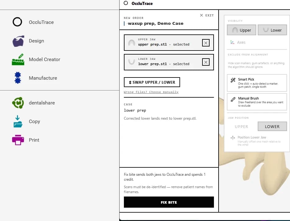 The OccluTrace entry in the exocad project menu and the Connector order panel opened over a live exocad case.